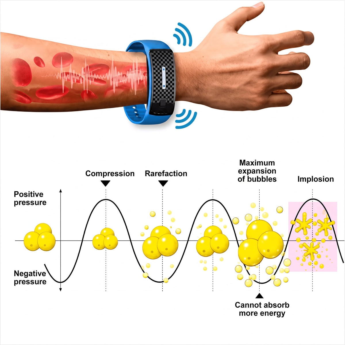 Ultrasonic Mosquito Repellent Bracelet for Kids and Pets – USB Rechargeable, 150 Hours Protection - We are MFEO