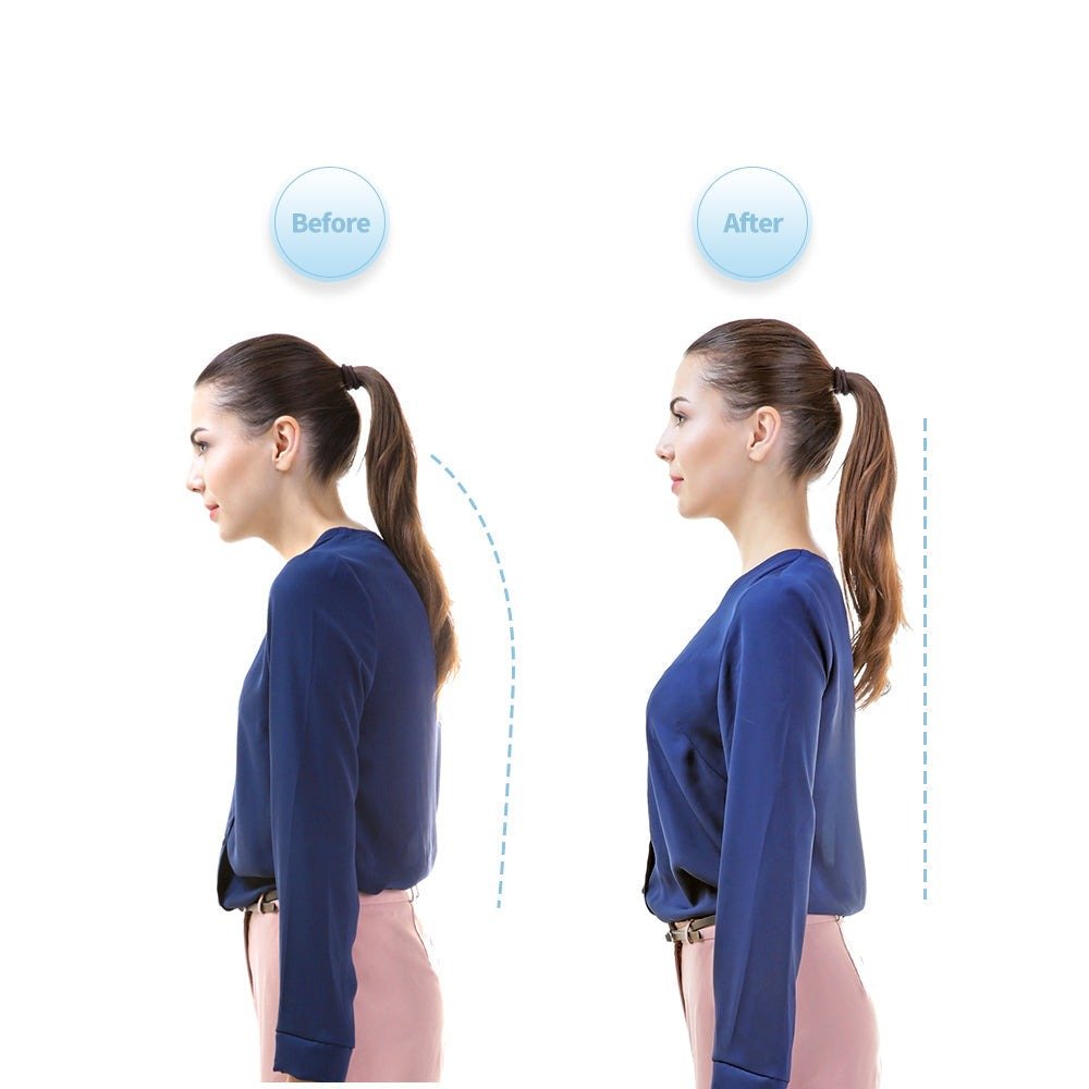 A side-by-side comparison showing a woman with poor posture on the left and improved, upright posture on the right.