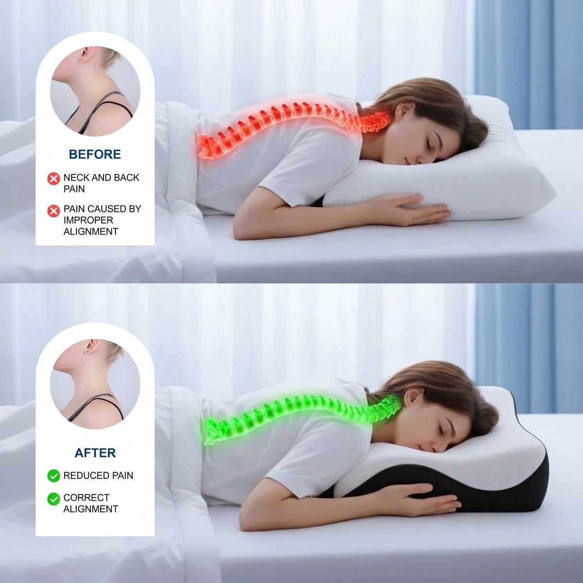 Comparison of a woman sleeping with a standard pillow causing neck pain versus an ergonomic pillow providing spinal support.